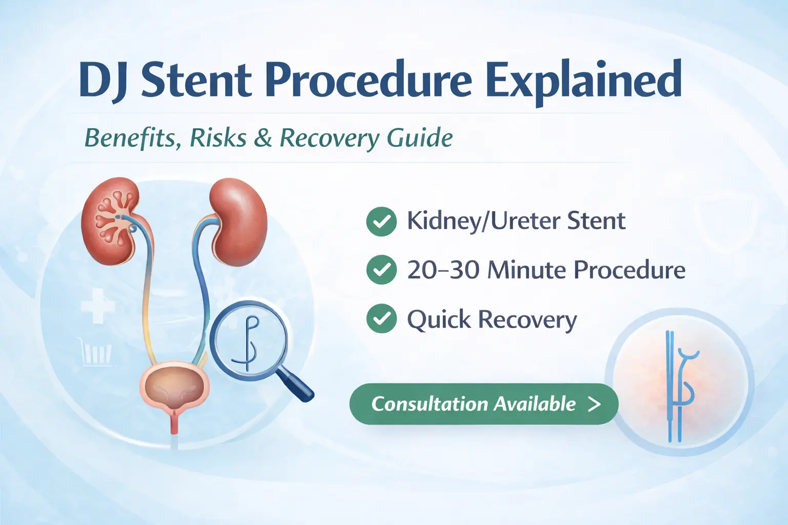 DJ Stent Procedure